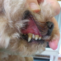 １回目で犬歯の歯石がきれいに取れました